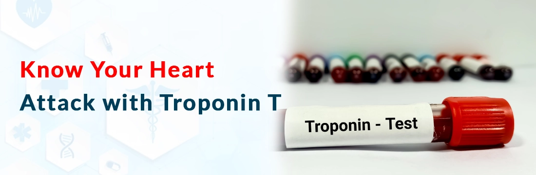 Know Your Heart Attack with Troponin T